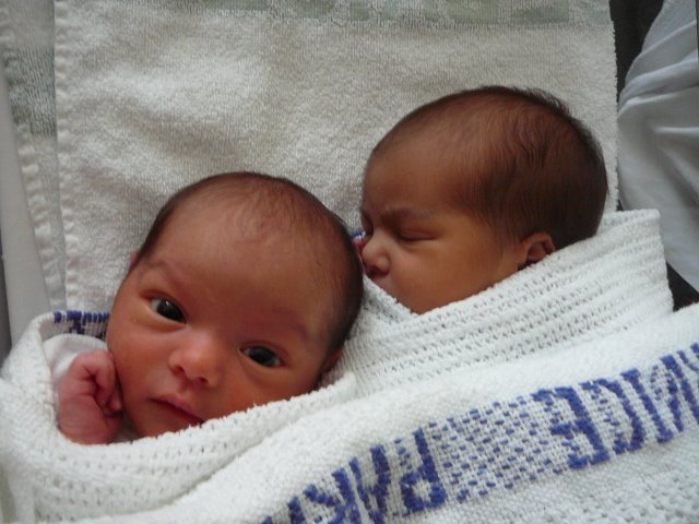 Newborn Twins a couple of days after birth